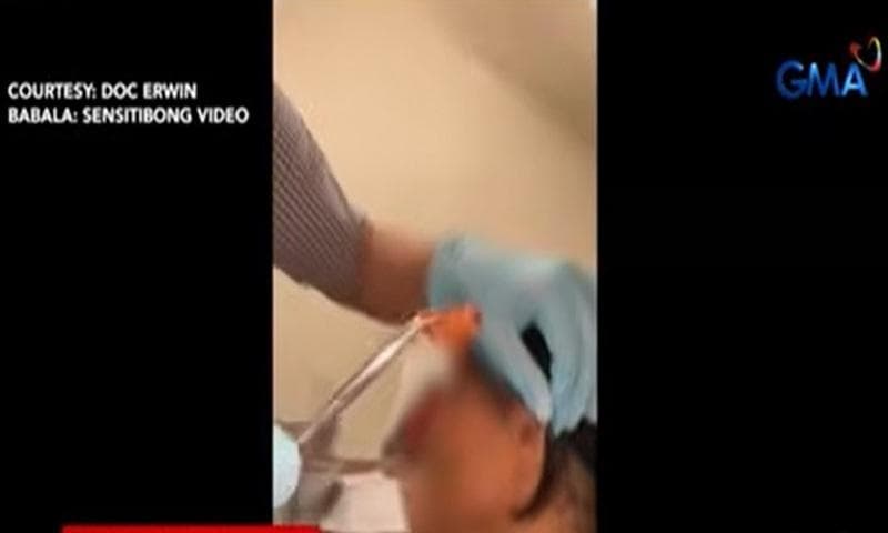 Insekto, pumasok sa tainga ng isang babae sa Romblon