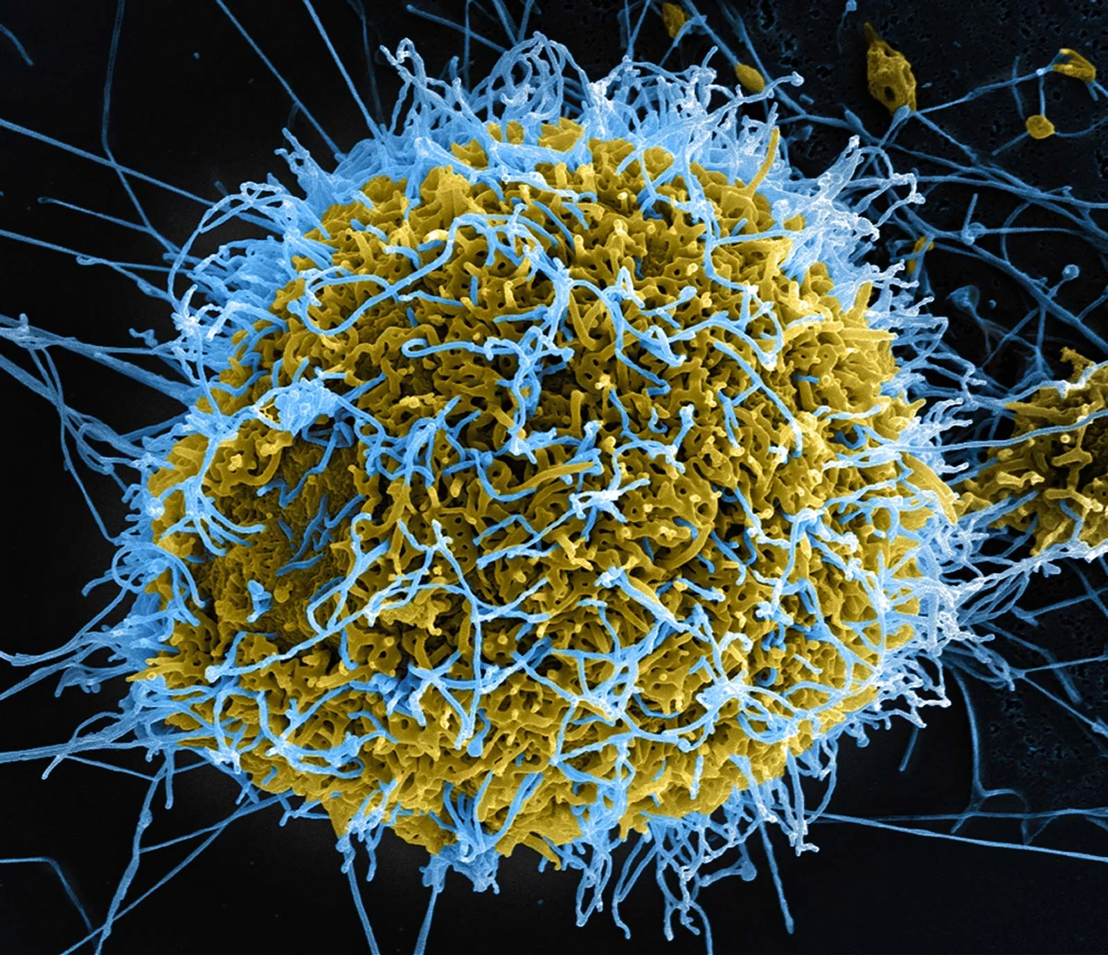 Mahigit 2,500 nasawi sa Ebola sa Congo