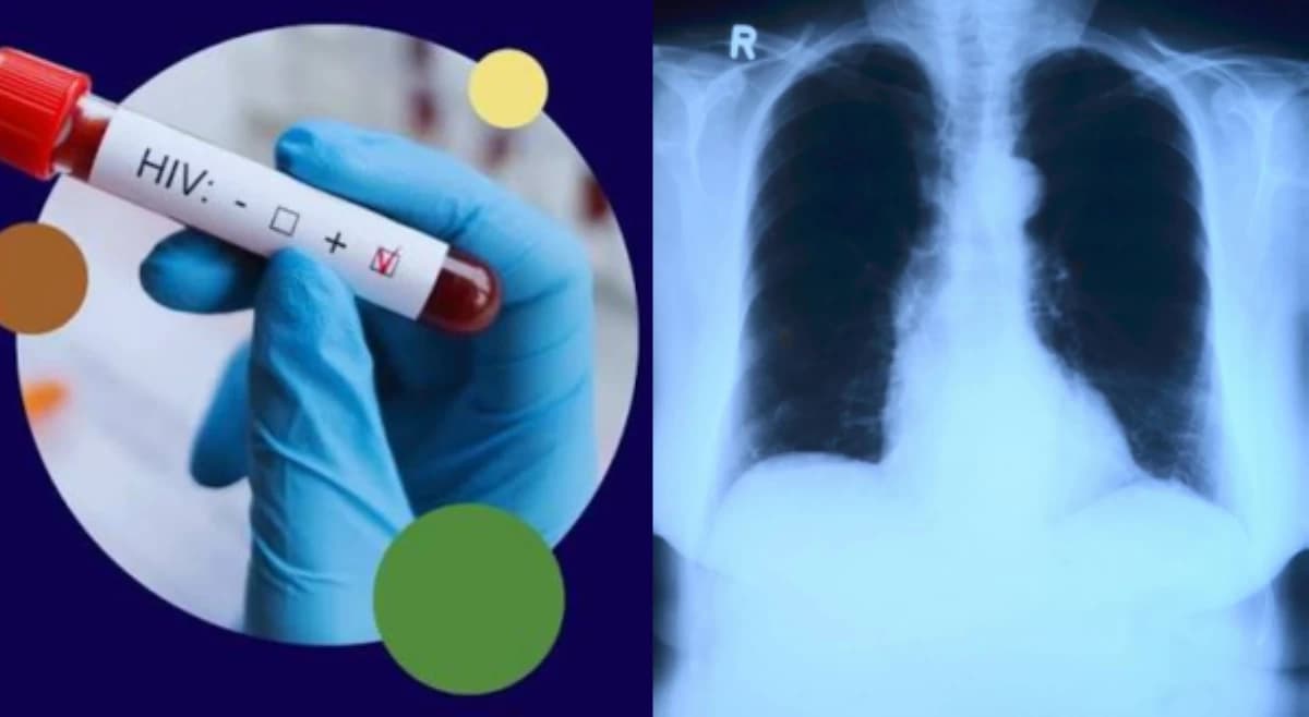 Paano Labanan ang HIV at Tuberculosis sa Pilipinas